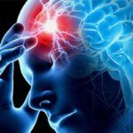 Инсульт «молодеет» и его все чаще диагностируют у людей среднего возраста, предупреждает Минздрав