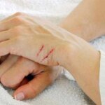 В Минздраве напомнили, что в случае укуса бродячего животного необходимо обязательно обратиться к врачу