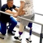 Минобороны: людей, имеющих ампутацию в результате войны, меньше, чем можно себе представиь