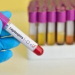 На Черниговщине у женщины обнаружили лептоспироз: что известно