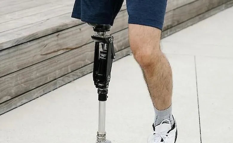 Учреждения здравоохранения в этом году заявили о потребности в более 12 тыс. эндопротезов — Минздрав