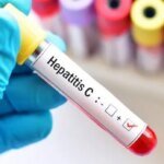В Украине за один год количество осужденных с гепатитом C выросло втрое