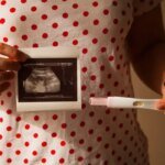 977 украинок получили бесплатное лечение бесплодия, 368 забеременели — Минздрав