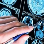 Ученые обнаружили новый признак ранней стадии болезни Альцгеймера