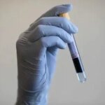 Первый в мире анализ крови на эндометриоз стал ближе после успешного испытания