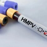 В Киеве зафиксирован один случай метапневмовируса: что стоит знать о HMPV