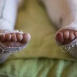 Монополия в медицине: почему в Украине только один врач занимается пациентами с буллезным эпидермолизом?