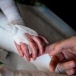 Международная практика лечения «людей-бабочек» обновляется, но в Украине застыла во времени