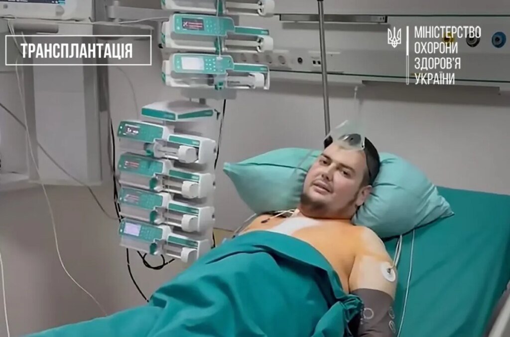 В Украине впервые провели операцию по повторной трансплантации сердца
