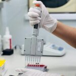 Трансплантация в Украине: в Центре имени Шалимова рассказали, что влияет на успех операции