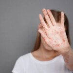 В Украине резко возросло количество больных корью: где фиксировали вспышки и как защититься
