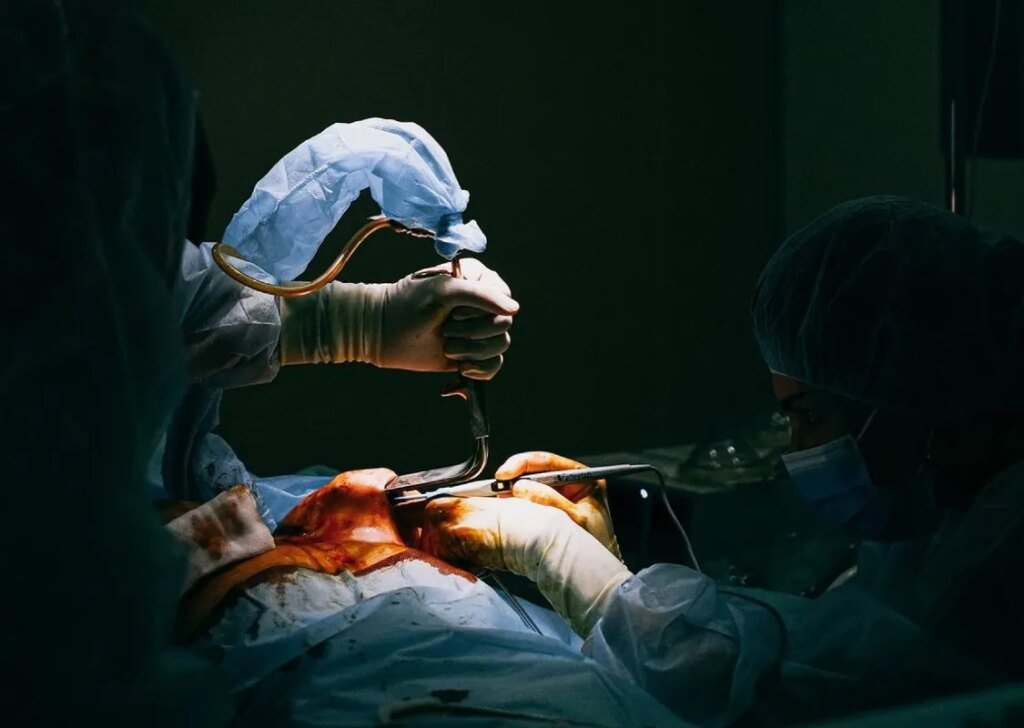 Зеленский подписал закон о запрете трансплантации органов погибших военных