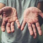 Заболеваемость корью в ближайшие недели, скорее всего, будет расти — иммунолог