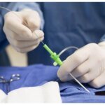 Эндоваскулярная хирургия: в Центре Шалимова объяснили преимущества миниинвазивных операций