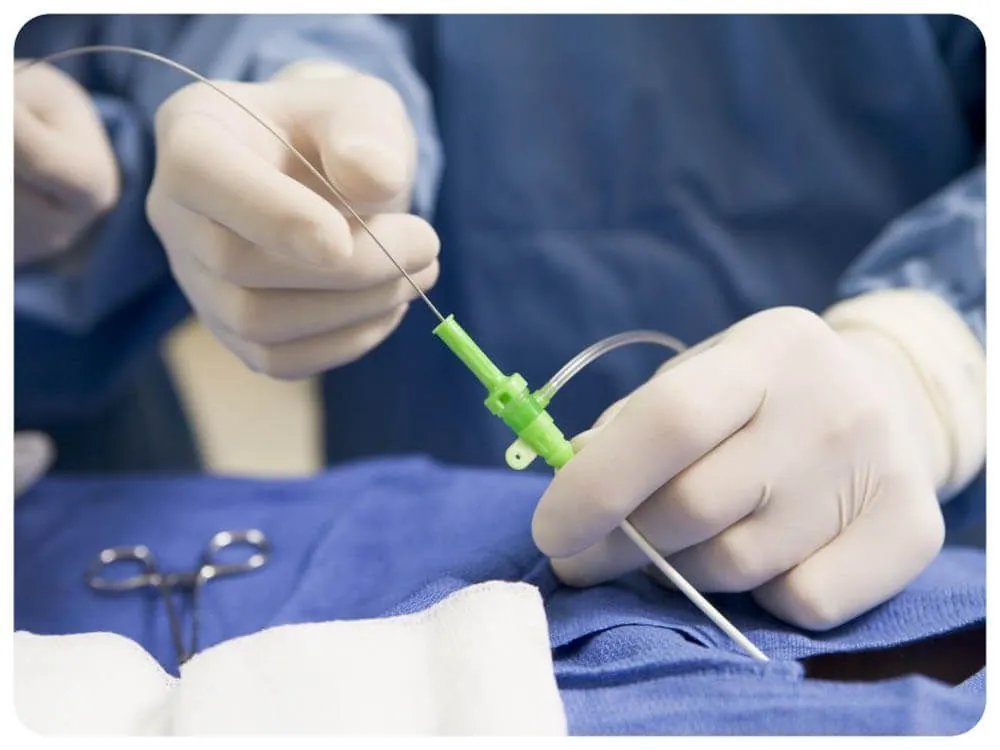 Эндоваскулярная хирургия: в Центре Шалимова объяснили преимущества миниинвазивных операций