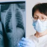 Профилактическое лечение туберкулеза в Украине: каковы ключевые аспекты и преимущества