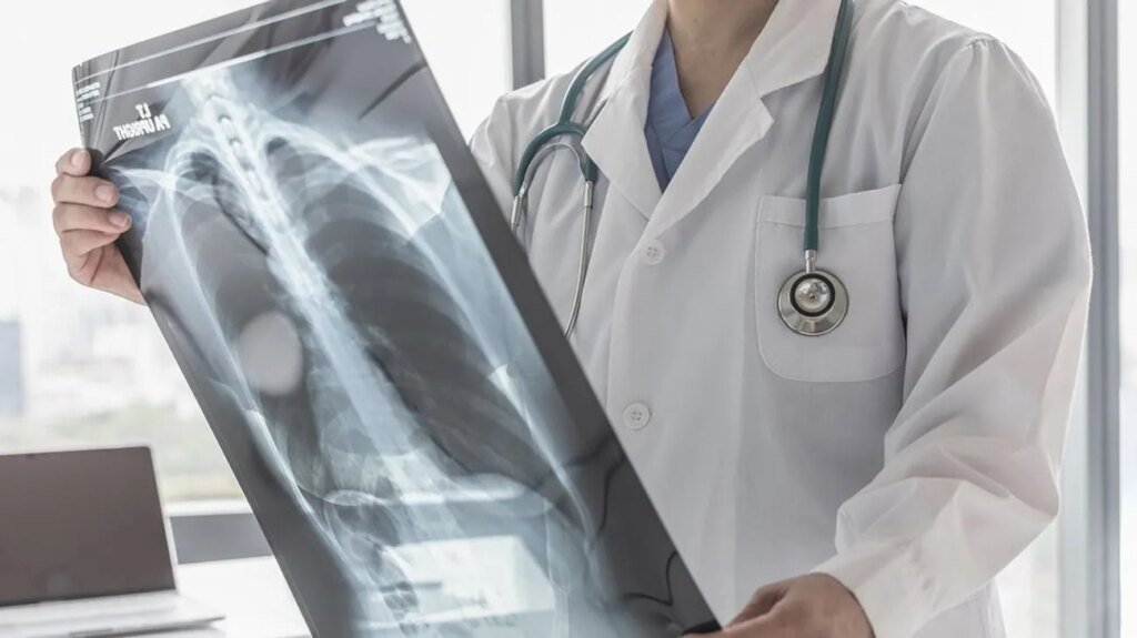 Туберкулез остается довольно серьезным вызовом для системы общественного здоровья Украины — ЦОЗ