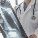 Туберкулез остается довольно серьезным вызовом для системы общественного здоровья Украины — ЦОЗ