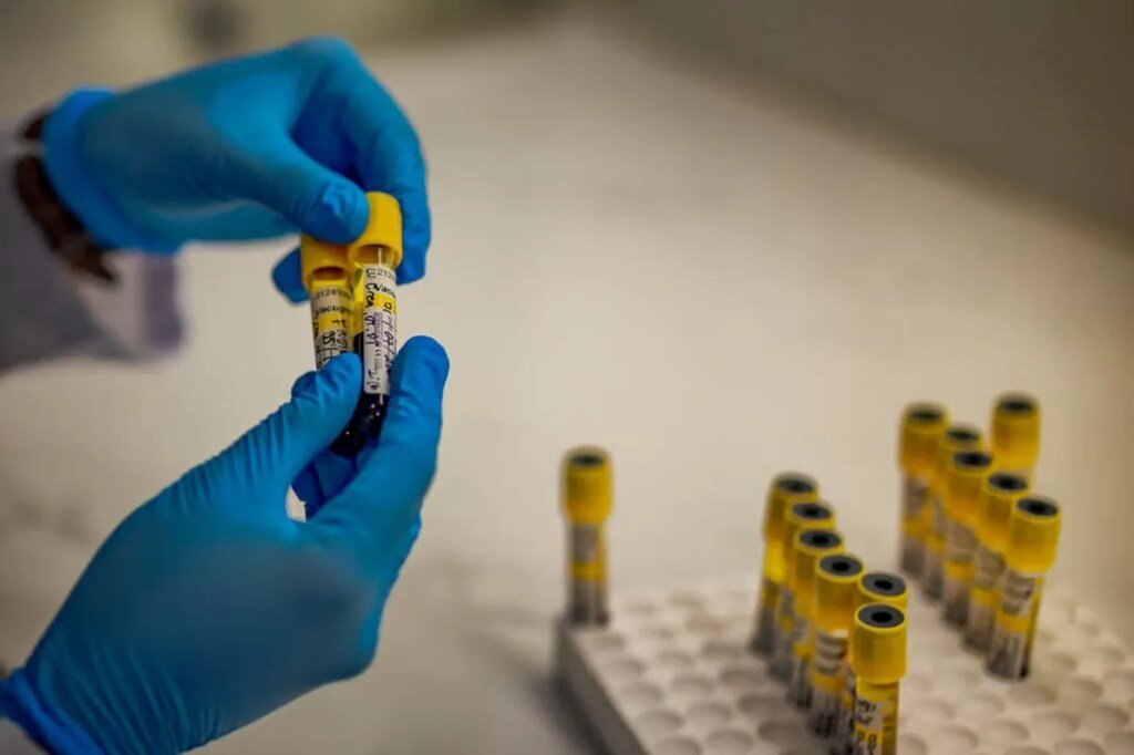 Количество смертей от ВИЧ в мире может вырасти на 3 миллиона из-за сокращения иностранной помощи — исследование