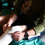 В Минздраве сообщили, на каком этапе согласования нового метода протезирования