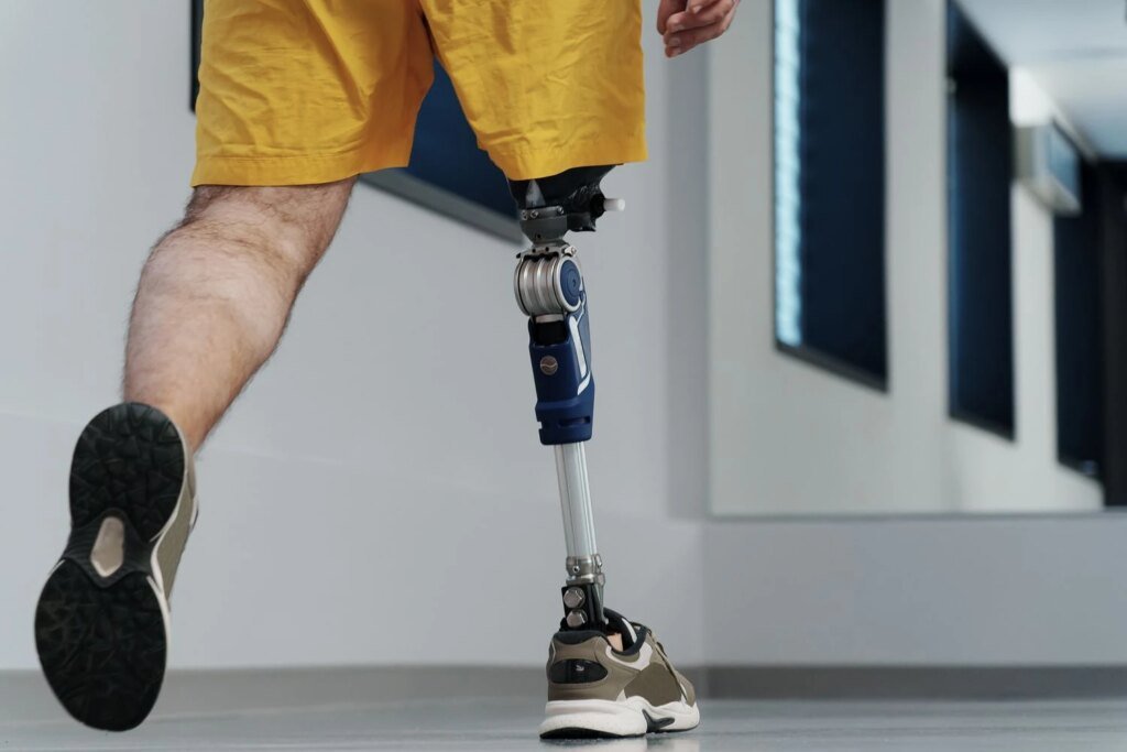 Фонд Андрея Матюхи помог запустить цифровой хаб «Є — ПРОТЕЗ»