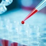 Ученые обнаружили антитело, блокирующее почти все варианты ВИЧ-инфекции