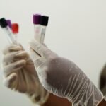 Спрос на анализы по ПМГ значительно превышает законтрактованные НСЗУ объемы с частными лабораториями — мнение