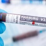 В Эфиопии подтверждена вспышка болезни, вызванной вирусом Марбурга