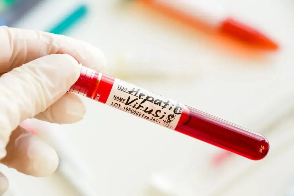 Дистанционное обучение в школах, закрытые кафе и запрет на туристов: в селе на Закарпатье вводят жесткий карантин из-за повторной вспышки гепатита А