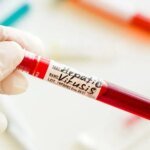 Дистанционное обучение в школах, закрытые кафе и запрет на туристов: в селе на Закарпатье вводят жесткий карантин из-за повторной вспышки гепатита А