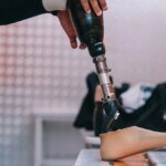 В Украине повысят доступность протезов и ортезов для пострадавших от агрессии РФ: что изменится