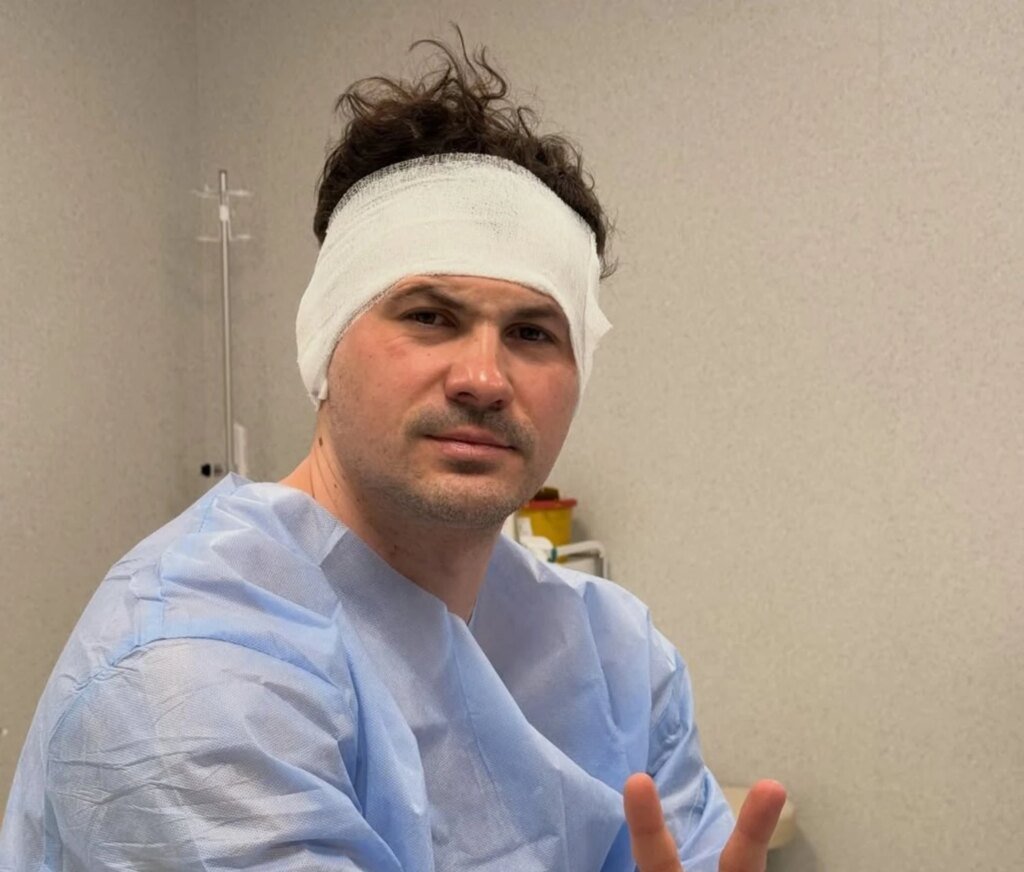 Женя Кот перенес операцию и показался с перевязанной головой: танцор рассказал о своем состоянии