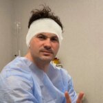 Женя Кот перенес операцию и показался с перевязанной головой: танцор рассказал о своем состоянии