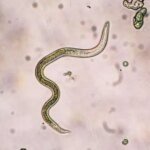 ВОЗ предостерегает: "гибридные паразиты" шистосомоза, поражающие внутренние органы, могут распространиться по всему миру