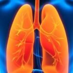 Роста заболеваемости туберкулезом в Украине нет, но есть случаи внелегочного туберкулеза — гендиректор ЦОЗ