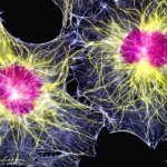 Япония первой в мире одобрила лечение болезни Паркинсона стволовыми клетками